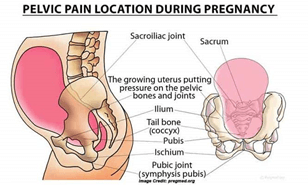 Upper back pain in pregnancy — Ballsbridge Physiotherapy Clinic